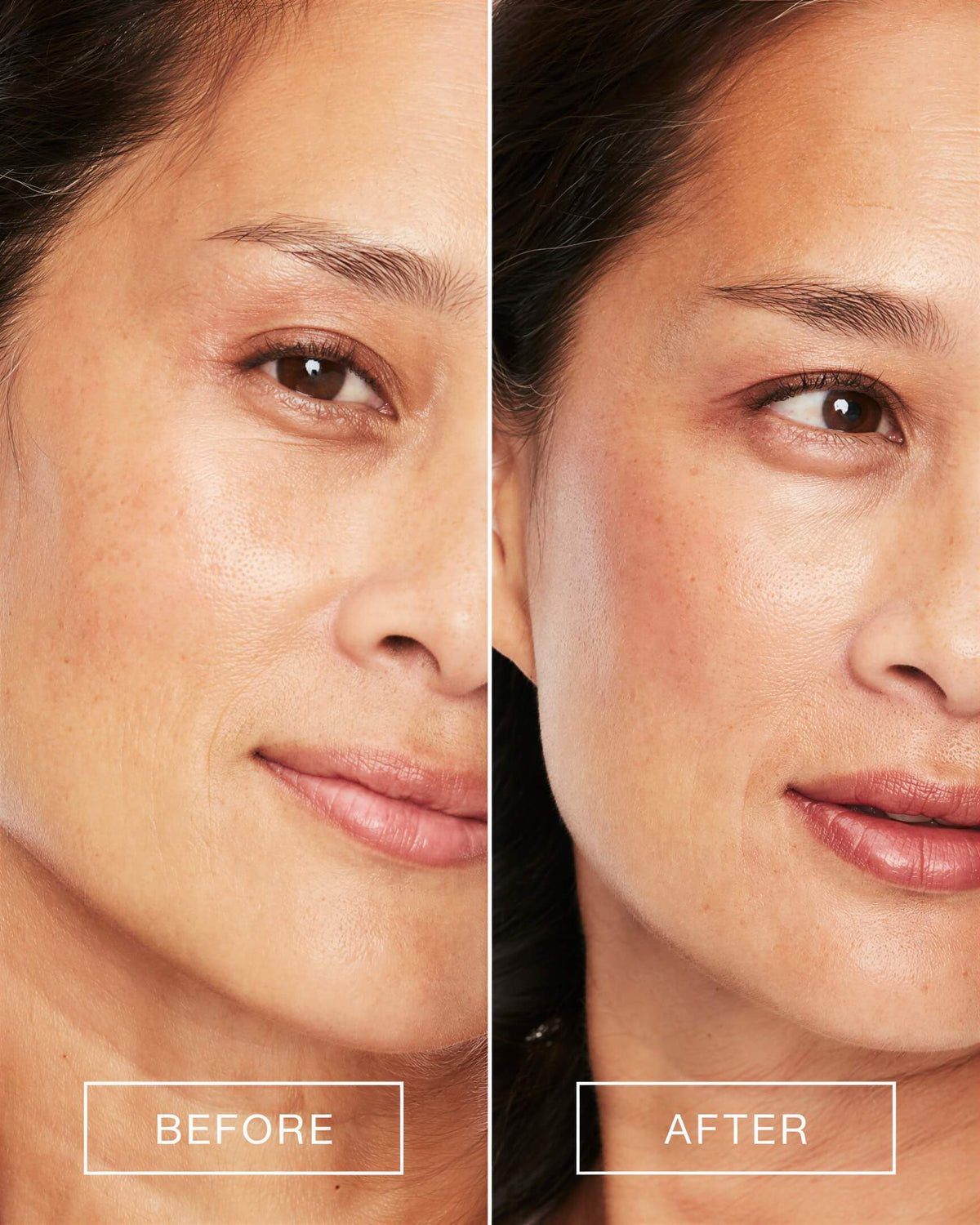 Side-by-side before and after comparison of a woman&