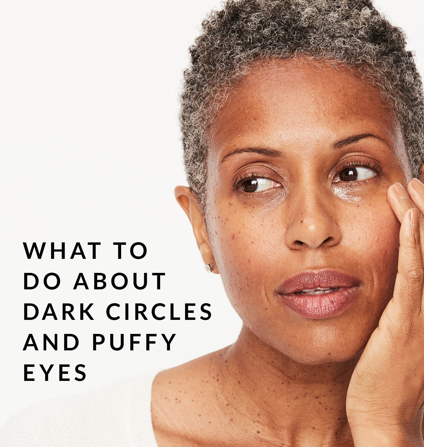Dark Circles Puffy Eyes